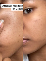 Charger l'image dans la galerie, Centella -Tone Brightening Capsule Ampoule
