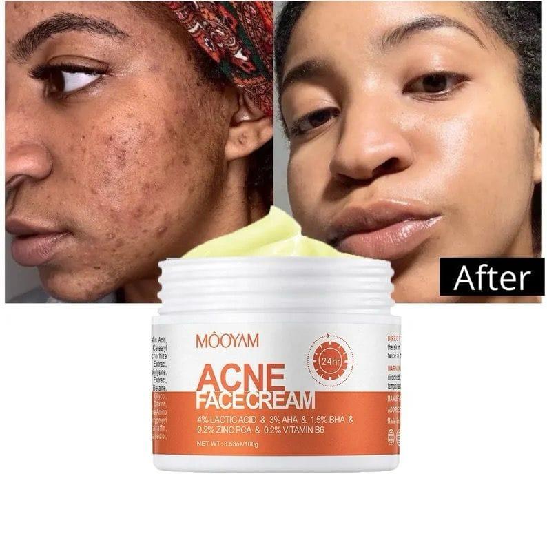 Crème visage anti-Tâche MOOYAM