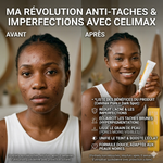 Charger l'image dans la galerie, Celimax Brightening Cream_Crème Correctrice Anti-Taches &amp; Pores
