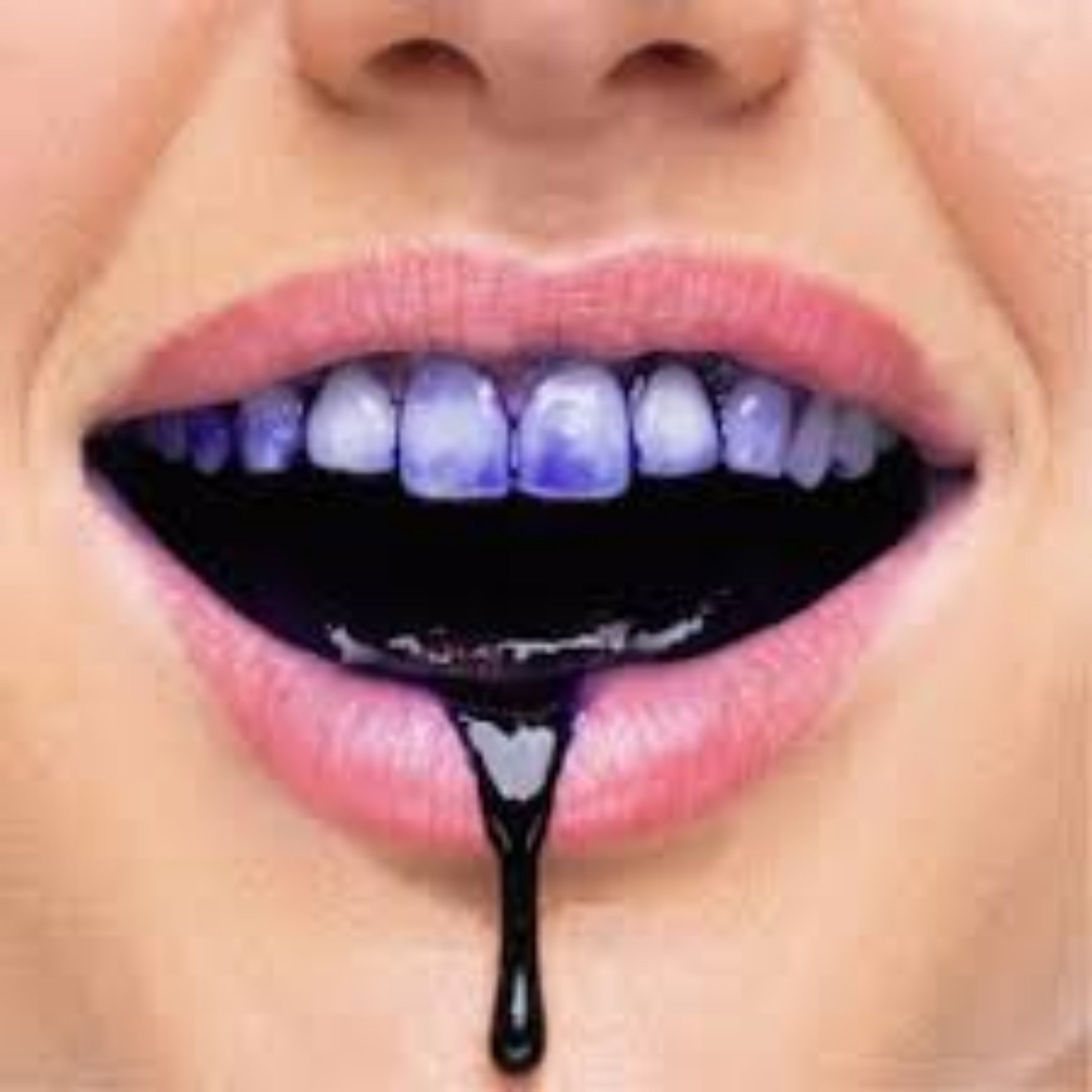 Hismile-Correcteur de couleur v34™
