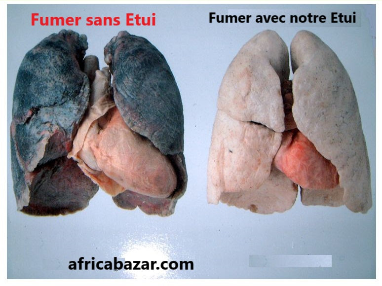 Étui à cigarettes avec compartiment pour filtre transparent : Élégance, protection et filtration optimale pour votre plaisir